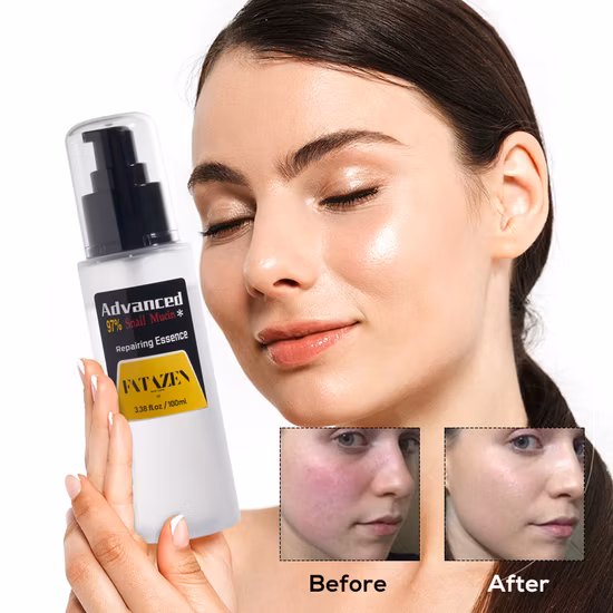 도매 스킨 케어 Granactive Retinoid 2% 유제 스쿠알란 세럼 노화 방지 주름 필링